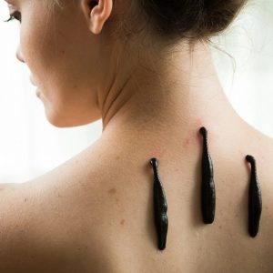 П’явка: від болотного мешканця до медичного союзника